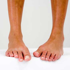 Photo of foot