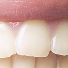 Photo of tooth