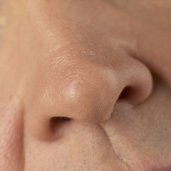Photo of nose