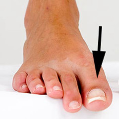 Photo of toe